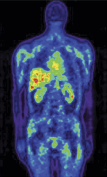 Radio Isotopes Antibody probes
